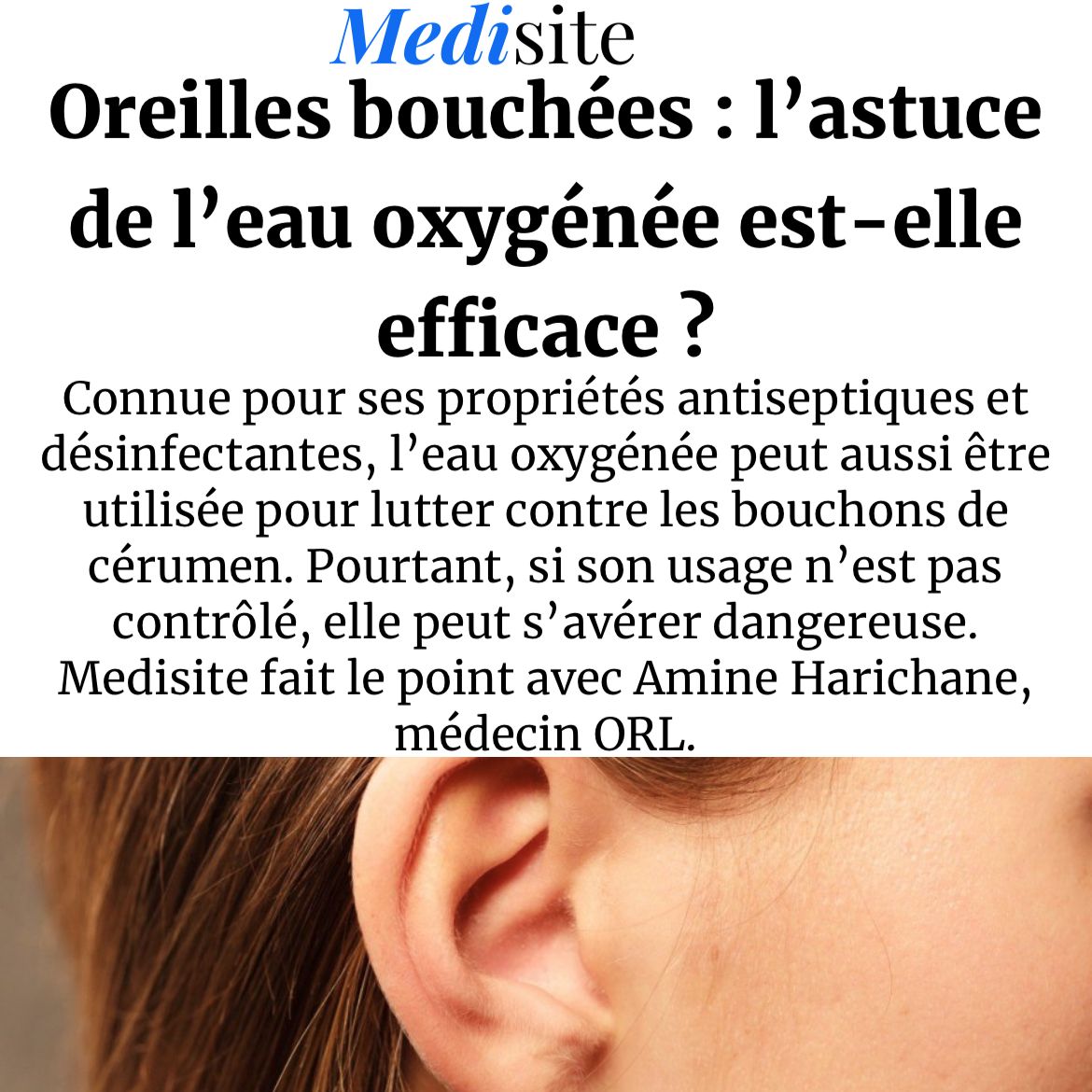 article medisite oreilles bouchées eau oxygénée